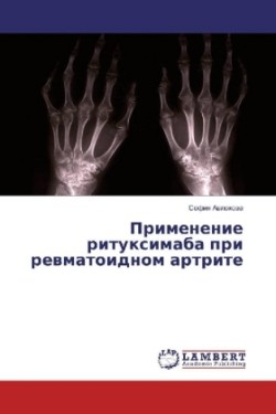 Primenenie rituximaba pri revmatoidnom artrite