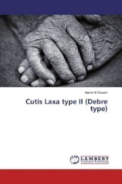 Cutis Laxa type II (Debre type)