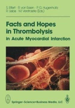 Facts and Hopes in Thrombolysis in Acute Myocardial Infarction