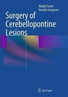 Surgery of Cerebellopontine Lesions