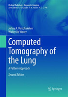 Computed Tomography of the Lung