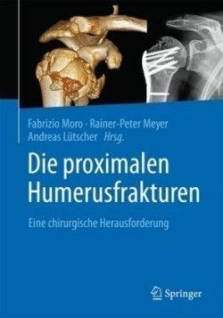 Die proximalen Humerusfrakturen