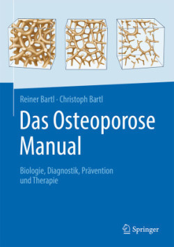 Das Osteoporose Manual