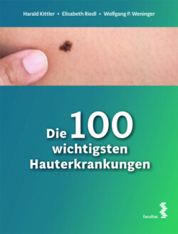 Die 100 wichtigsten Hauterkrankungen