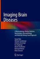 Imaging Brain Diseases