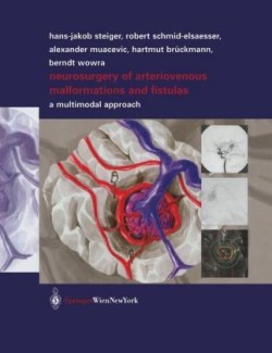 Neurosurgery of Arteriovenous Malformations and Fistulas