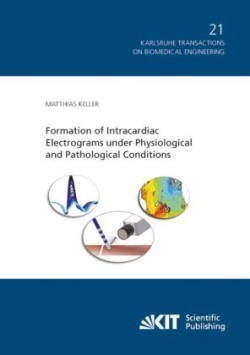 Formation of Intracardiac Electrograms under Physiological and Pathological Conditions