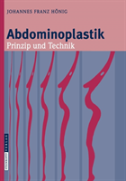 Abdominoplastik