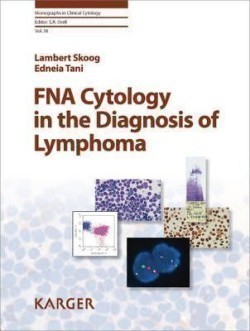 FNA Cytology in Diagnosis of Lymphoma