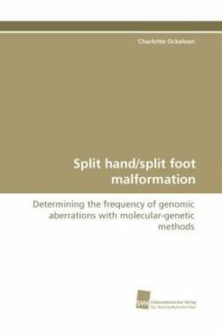 Split Hand/Split Foot Malformation