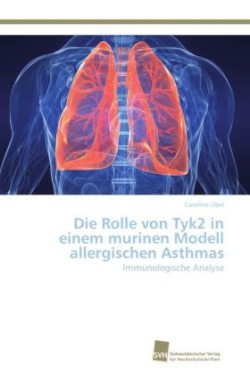 Rolle von Tyk2 in einem murinen Modell allergischen Asthmas