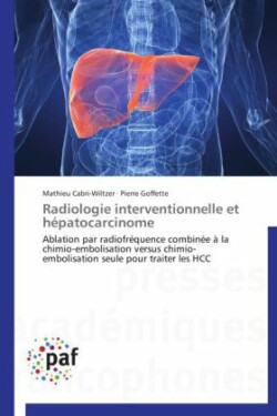 Radiologie Interventionnelle Et Hépatocarcinome