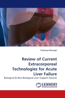 Review of Current Extracorporeal Technologies for Acute Liver Failure