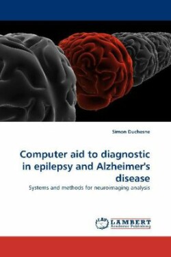 Computer aid to diagnostic in  epilepsy and  Alzheimer's disease