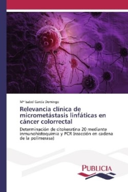 Relevancia clínica de micrometástasis linfáticas en cáncer colorrectal