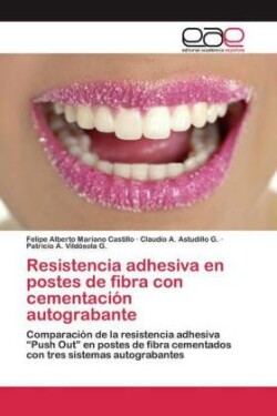 Resistencia adhesiva en postes de fibra con cementación autograbante