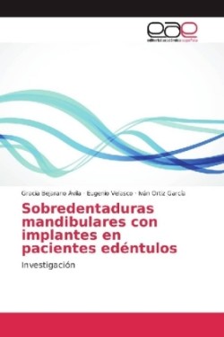 Sobredentaduras mandibulares con implantes en pacientes edéntulos