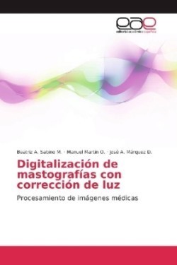 Digitalización de mastografías con corrección de luz