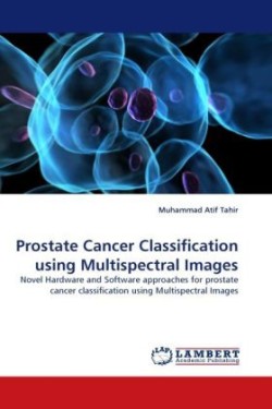 Prostate Cancer Classification using Multispectral Images