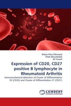Expression of CD20, CD27 positive B lymphocyte in Rheumatoid Arthritis