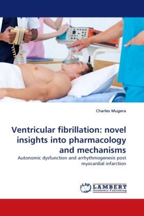 Ventricular fibrillation