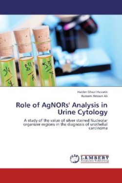 Role of Agnors' Analysis in Urine Cytology