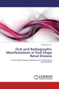 Oral and Radiographic Manifestations in End-Stage Renal Disease