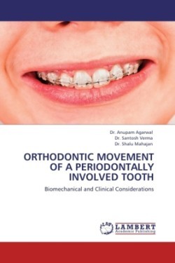 Orthodontic Movement of a Periodontally Involved Tooth