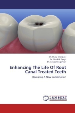 Enhancing The Life Of Root Canal Treated Teeth