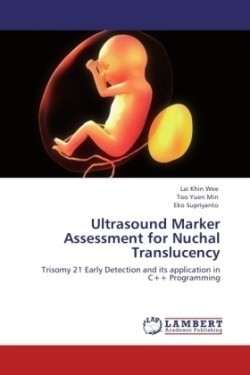 Ultrasound Marker Assessment for Nuchal Translucency