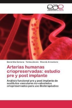 Arterias humanas criopreservadas