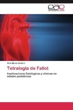 Tetralogia de Fallot