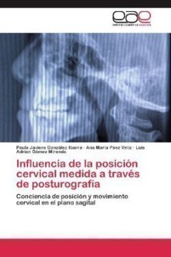 Influencia de la posición cervical medida a través de posturografía