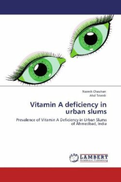 Vitamin A deficiency in urban slums