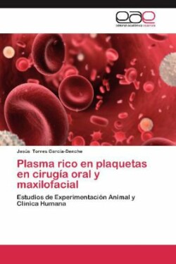 Plasma Rico En Plaquetas En Cirugia Oral y Maxilofacial