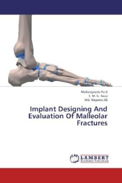 Implant Designing and Evaluation of Malleolar Fractures