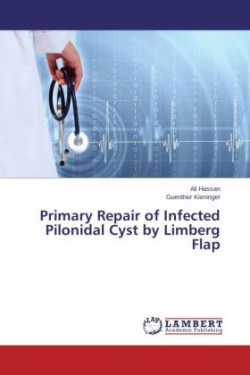 Primary Repair of Infected Pilonidal Cyst by Limberg Flap