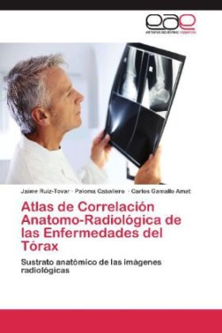 Atlas de Correlación Anatomo-Radiológica de las Enfermedades del Tórax