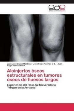 Aloinjertos óseos estructurales en tumores óseos de huesos largos