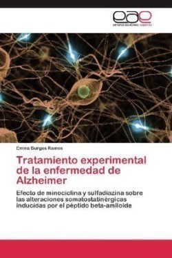 Tratamiento experimental de la enfermedad de Alzheimer