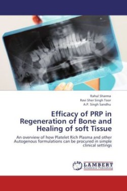 Efficacy of Prp in Regeneration of Bone and Healing of Soft Tissue