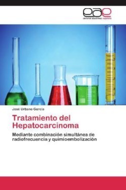 Tratamiento del Hepatocarcinoma