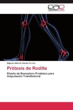 Protesis de Rodilla
