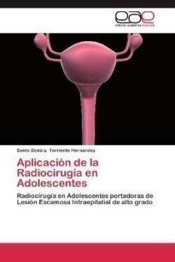 Aplicacion de La Radiocirugia En Adolescentes