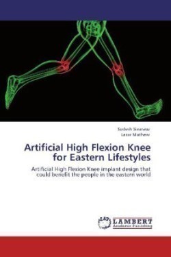 Artificial High Flexion Knee for Eastern Lifestyles