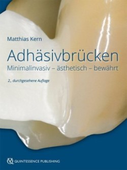 Adhäsivbrücken