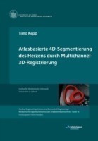 Atlasbasierte 4D-Segmentierung des Herzens durch Multichannel 3D-Registrierung