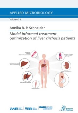 Model-informed treatment optimization of liver cirrhosis patients