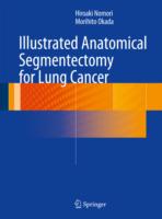 Illustrated Anatomical Segmentectomy for Lung Cancer