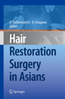 Hair Restoration Surgery in Asians